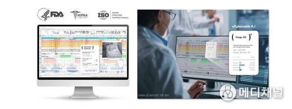 HoneyNaps Accelerates Clinical Trial Pipelines with FDA-Cleared AI “SOMNUM”